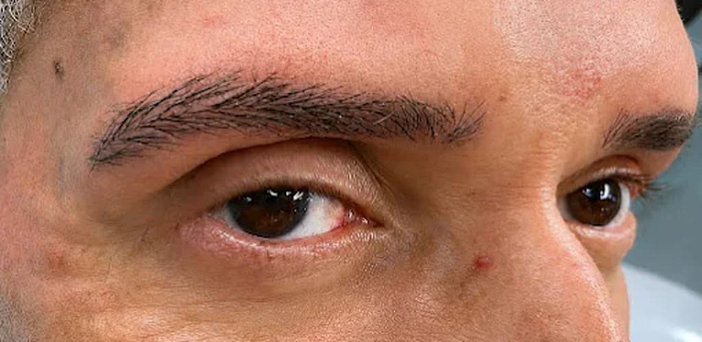 Depois — correção de falhas com micropigmentação de sobrancelhas
